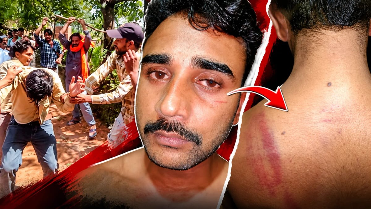 पति से मारपीट के बाद FIR की जगह NCR दर्ज करने का आरोप, मेडिकल कराने की मांग